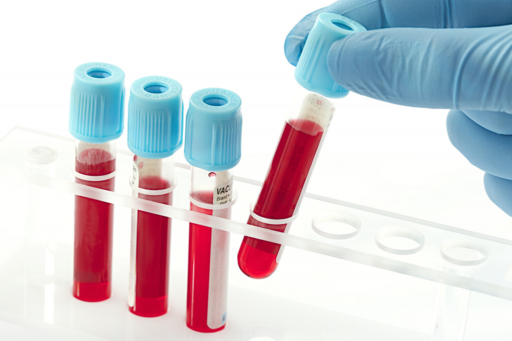 blood inside test tubes